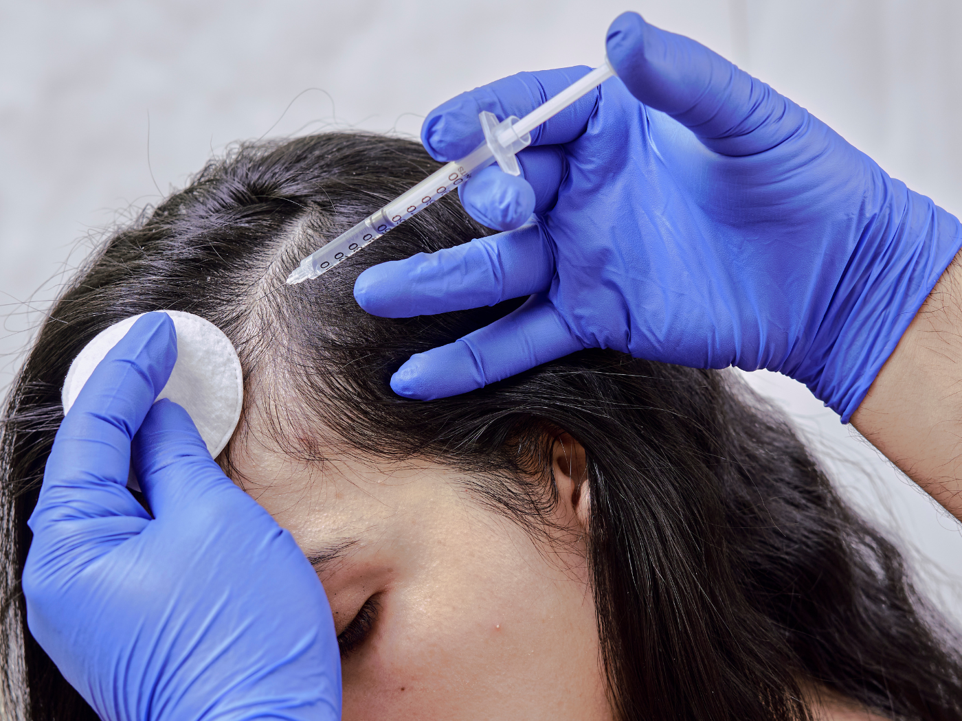 Scalp Treatments