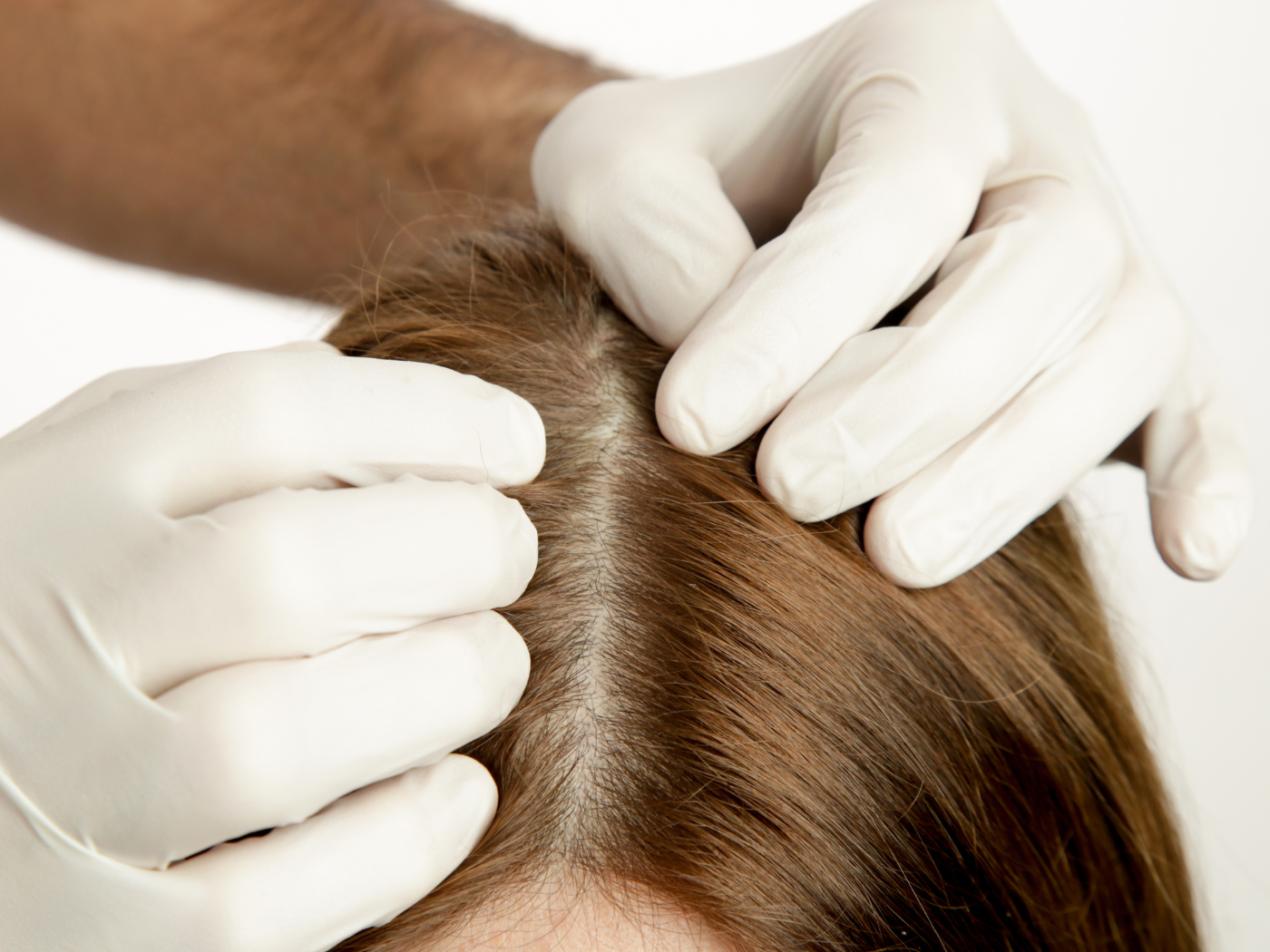 Anti Hair Fall